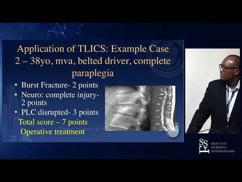 Essentials of Thorocolumbar Spine Trauma - D. Kojo Hamilton, MD