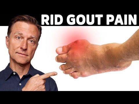 The #1 Best Protocol for Gout