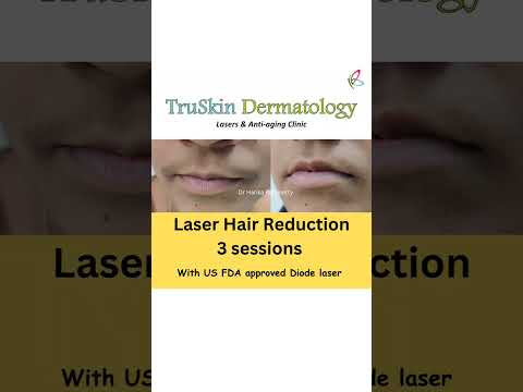 Best Laser Hair Reduction -US FDA approved Diode laser...