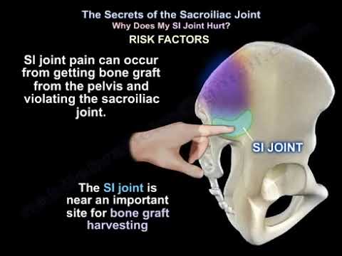 Tajemnica bólu stawu krzyżowo-biodrowego: dlaczego boli mnie ten staw?