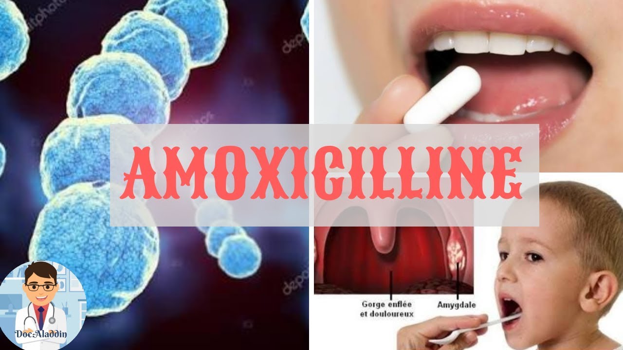 Watch video AMOXICILLINE ( 1g,500mg 250mg...) / TOUT SUR CE MÉDICAMENT AMOXICILLINE ( 1g,500mg 250mg...) / TOUT SUR CE MÉDICAMENT