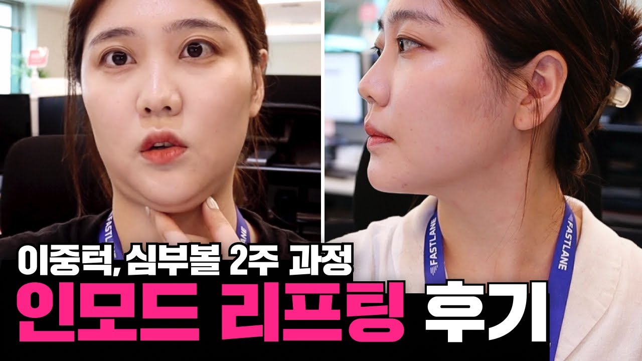 related_video_thumbnail