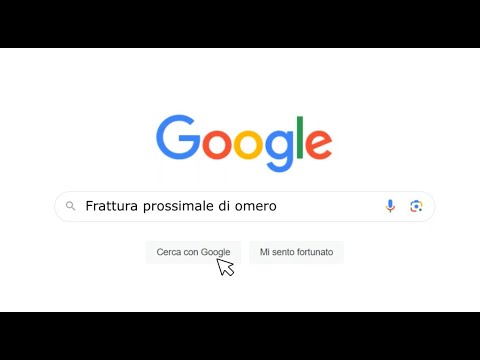 Frattura di omero