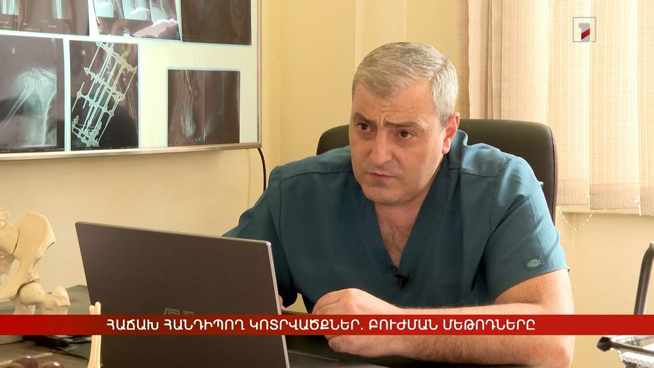 Հաճախ հանդիպող կոտրվածքներ. բուժման մեթոդները