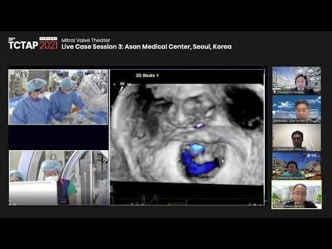 [TCTAP 2021 Virtual]  Mitral Valve Theater - Live Case Session 3