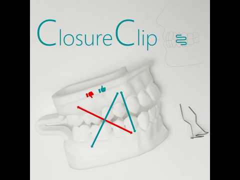 ClosureClip basic placement