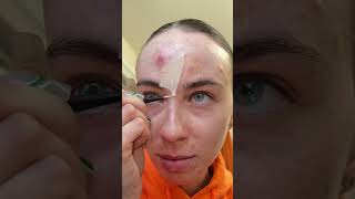 i love pimple patches