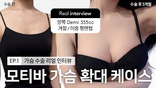 모티바 가슴성형 VLOG l 수술 당일 - 3달차 l 리얼 인터뷰 l 권순근 원장 l