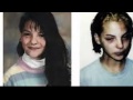Crystal Meth Before & After and its Devastating ...
