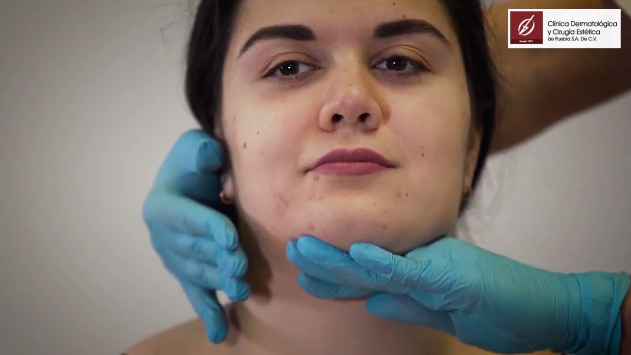 Aristides Arellano Huacuja-27