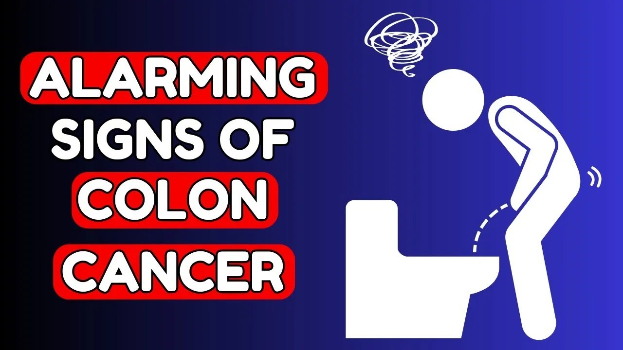 8 Warning Signs of COLON CANCER you Shouldn't Ignore | Nourish Hub