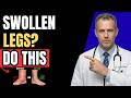 THIS 1 Simple Movement Drains Swollen Legs & Ankles Fast!
