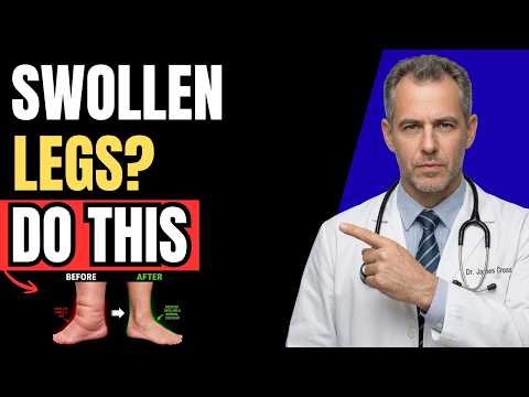 THIS 1 Simple Movement Drains Swollen Legs & Ankles Fast!