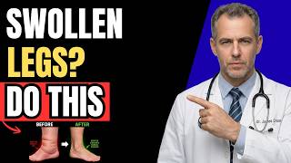THIS 1 Simple Movement Drains Swollen Legs & Ankles Fast!