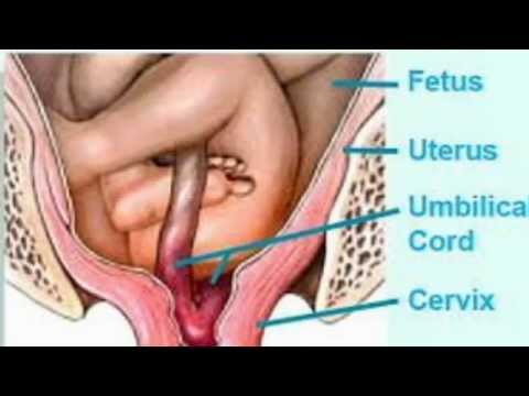 Tiroiditis dan pengobatan kelebihan berat badan autoimun Hasil dan orang-orang kehilangan kiat berat badan