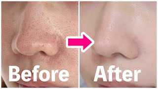 【毛穴落ちする人絶対見て✋🏻 】毛穴をカバーするNG,OKの塗り方&組み合わせ