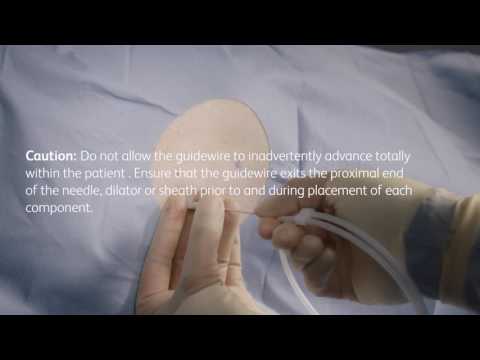 PleurX® pleural catheter placement video