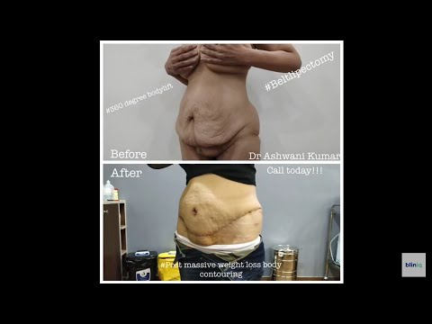 Patient Recovery Case — Video 2 (Clinical Testimonial)