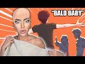 I Can T Grow Hair ANYWHERE On My Body True Story Animation