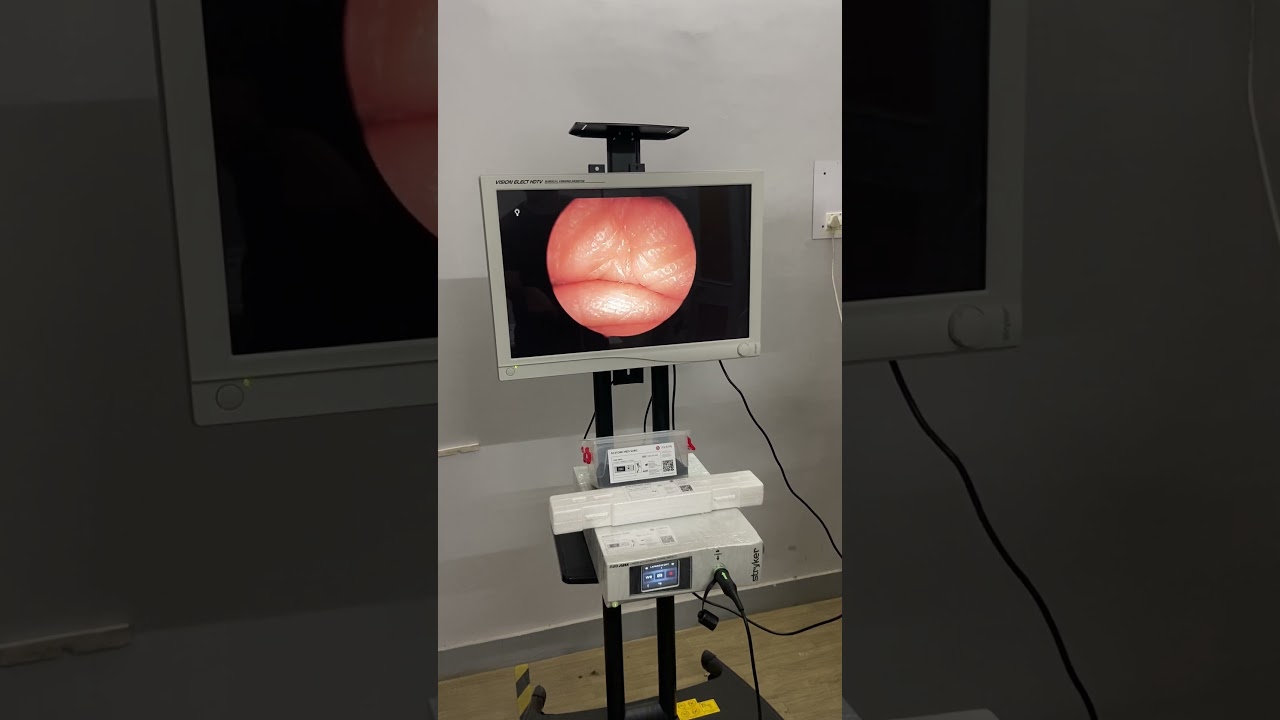 Stryker 1588 System Run