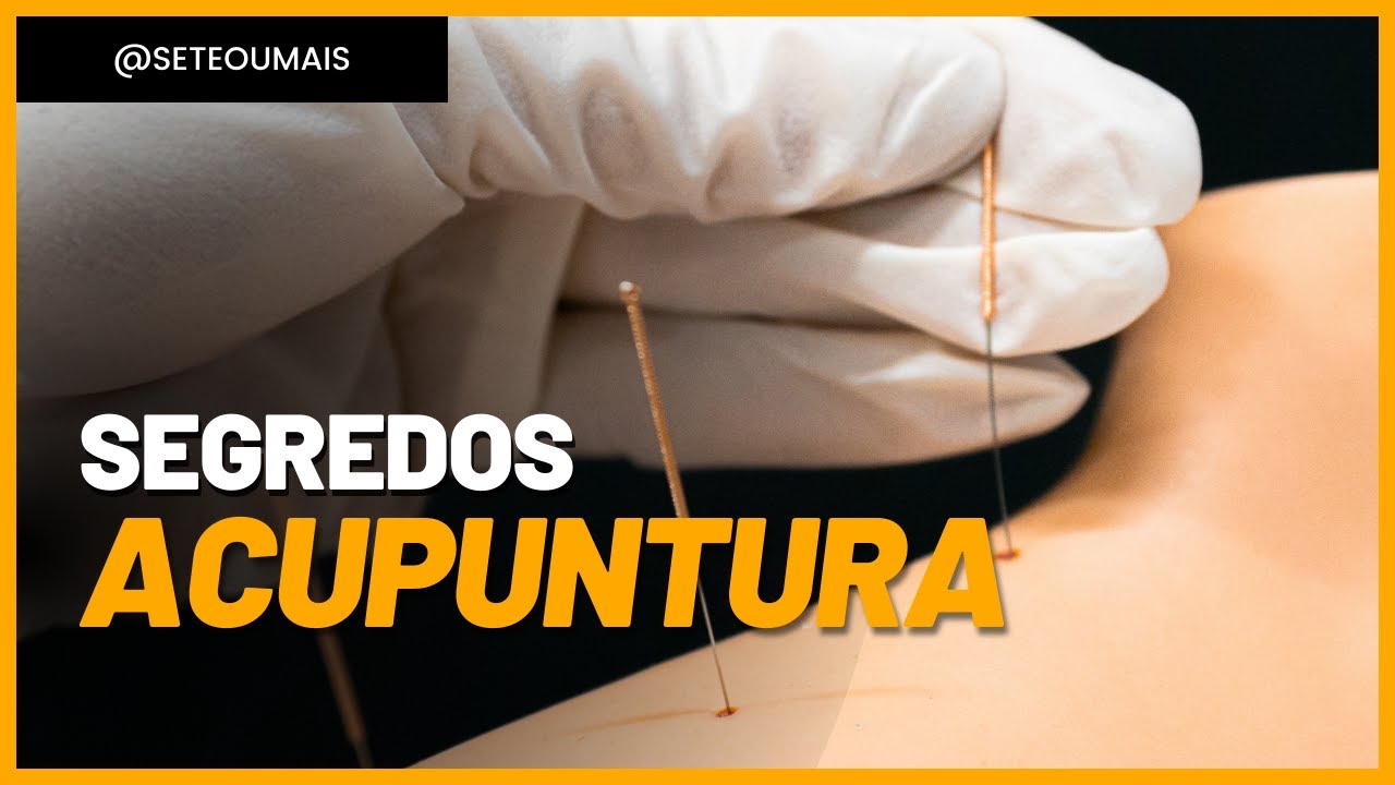 7+ Segredos da acupuntura que ninguém te conta