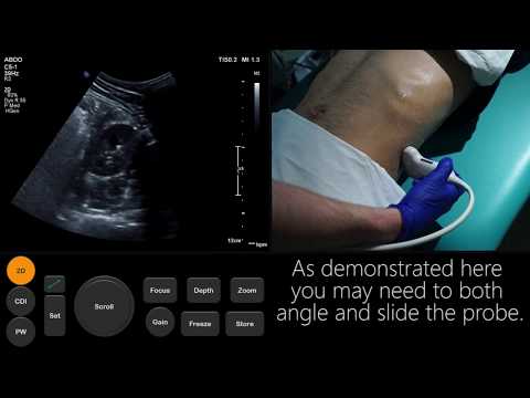 Ultrasound Tutorial: Kidney & Bladder / Urinary Tract | Radiology Nation