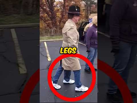 The world's only man with three legs🦵🦵🦵