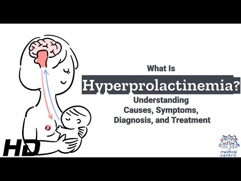 Hydrocephalus Causes Signs and Symptoms Diagnosis and Treatment