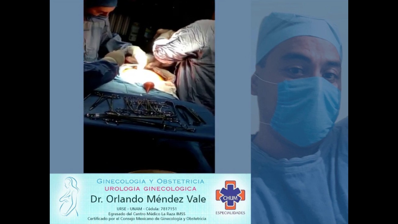 Orlando Méndez Vale-15