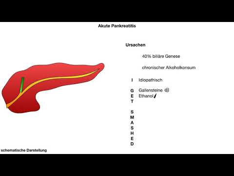 akute Pankreatitis  - Ursachen www.clipdocs.de