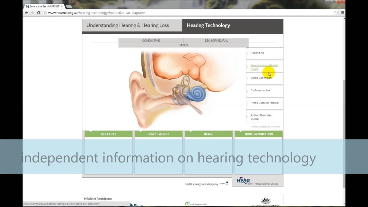 HEARnet's Interactive Ear