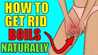 How to Get Rid of Boils on Inner Thighs and Buttocks NATURALLY