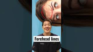 Can you get rid of forehead lines?