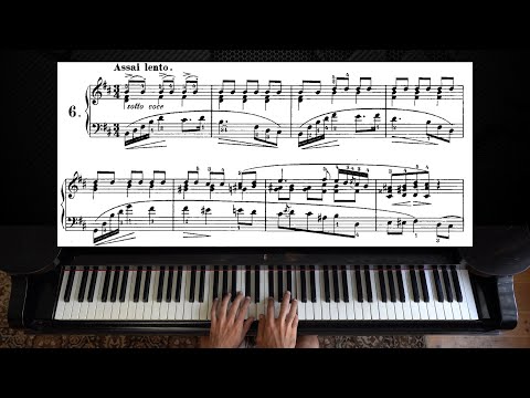 Chopin - Prelude Op. 28, No. 6 | Piano with Sheet Music