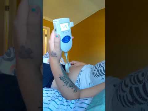 9 weeks 4 days babies heartbeat