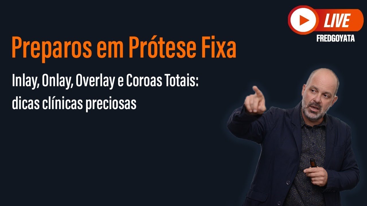 Preparos em Prótese Fixa - Inlay, Onlay, Overlay e Coroas Totais: Dicas Clínicas Preciosas