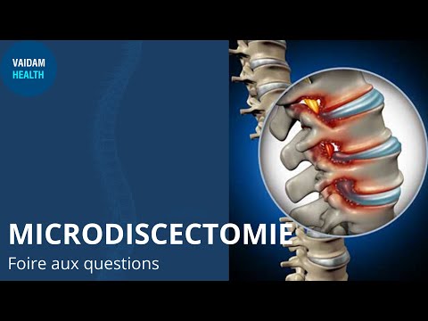MICRODISCECTOMIE