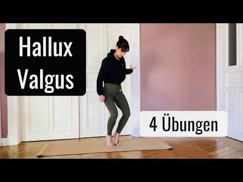 Get rid of hallux valgus with these 4 exercises and a hair tie