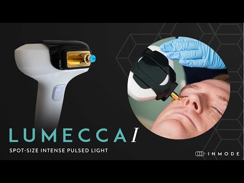 New Precision Dry Eye Treatment with Lumecca-I