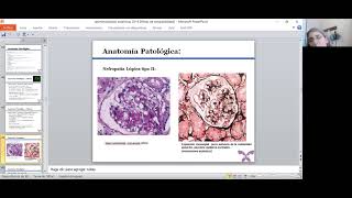 Glomerulopatias Sistémicas (Parte 2)