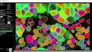 Cellpose2:  human-in-the-loop model training (2x speed)