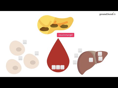 Was ist Typ-1-Diabetes?