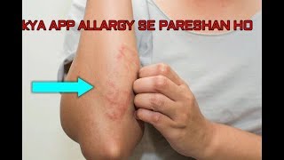کیا آپ کا بھی الرجی ہےDo you have allergies?کیا آپ پاکستان میں الرجی سے پریشان ہوں