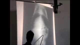 Pediatric Surgery - 1