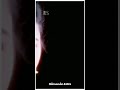 Sikkatha Sitrondru Full Screen WhatsApp Status Cute Love Sethu Movie