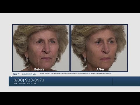 Get rid of those under eye bags with Plexaderm