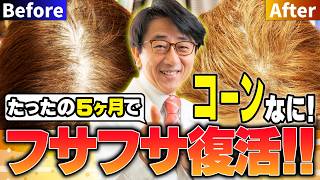 秋の抜け毛は怖くない！髪を「守り」「増やす」医学的メソッドはこれだ！