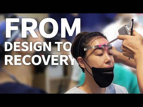 Real Patient Hair Transplant Surgery in Korea | Step-by-Step Guide
