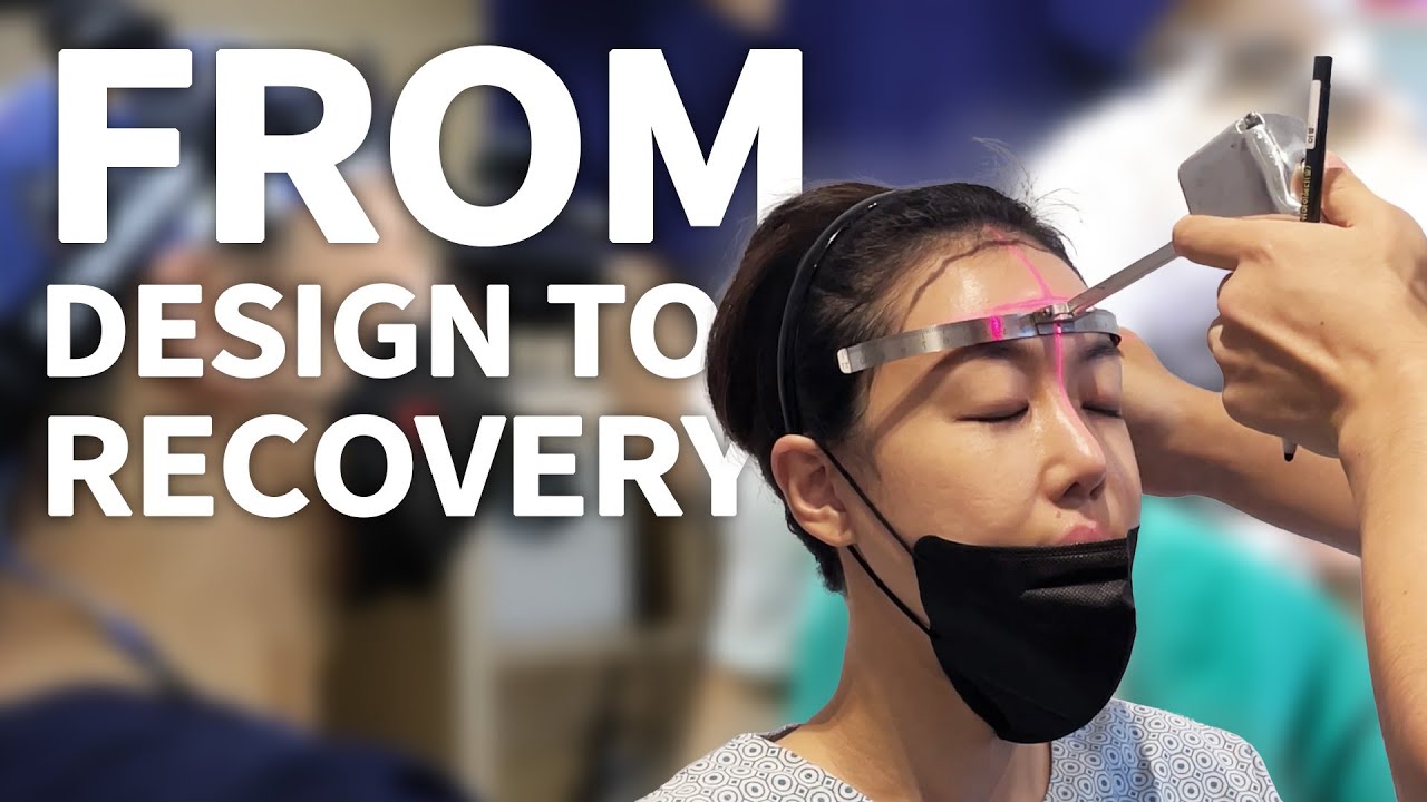 Real Patient Hair Transplant Surgery | Step-by-Step Guide