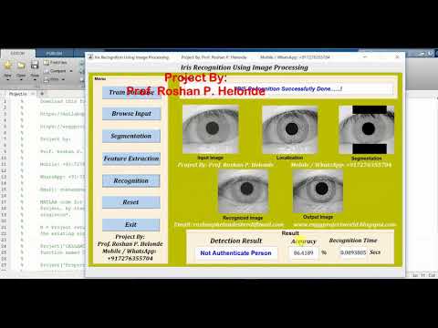 Iris Recognition Using Image Processing Matlab Project Source Code Final Year Project